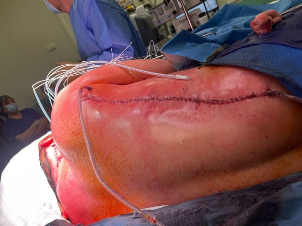 Otolaryngologia rekonstrukcja (1)