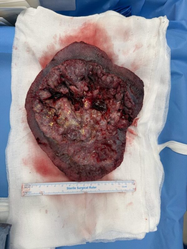 Otolaryngologia rekonstrukcja (2)