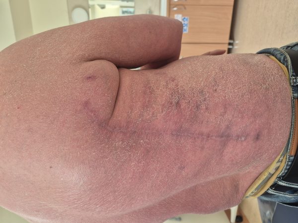 Otolaryngologia rekonstrukcja (3)